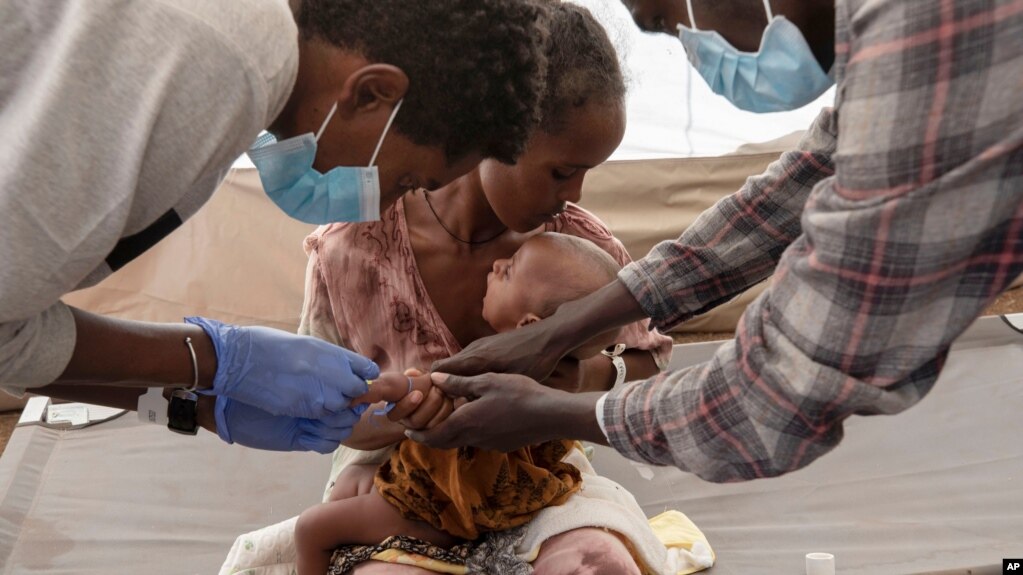 A Tigray woman who fled the conflict in Ethiopia's Tigray region, holds her malnourished and severely dehydrated baby as nurses give him IV fluids, at the Medecins Sans Frontieres (MSF) clinic, at Umm Rakouba refugee camp in Qadarif, eastern Sudan,…