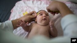 La cabeza de una bebé llamada Luiza es medida luego de que naciera con microcefalia, causada por el virus del Zika.