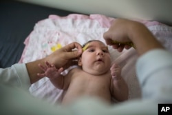 FILE - In this Dec. 22, 2015 photo, a baby named Luiza has her head measured by a neurologist in Caruaru, Brazil. Luiza, a Zika victim, was born in October with a head that was just 11.4 inches (29 centimeters) in diameter, below the range defined as healthy.