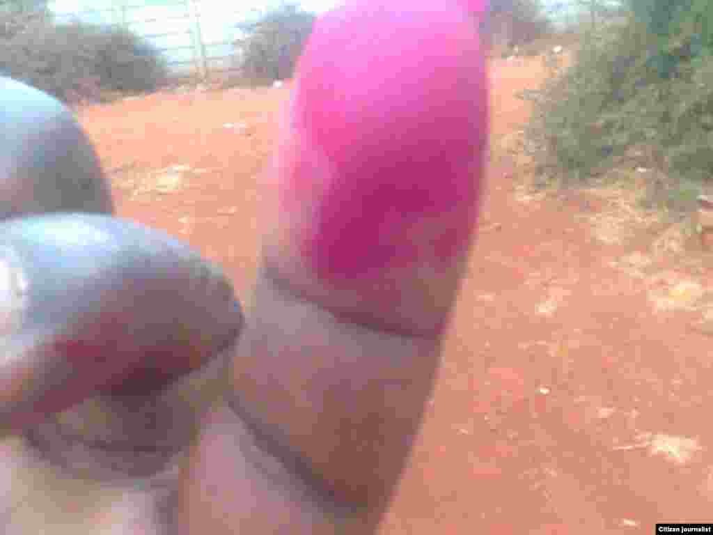 Voter proudly shows finger inked to indicate he has cast a ballot.