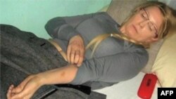 Julija Timošenko u zatvoru pokazuje modrice pošto su je, kako tvrdi, tukli stražari (arhiva)