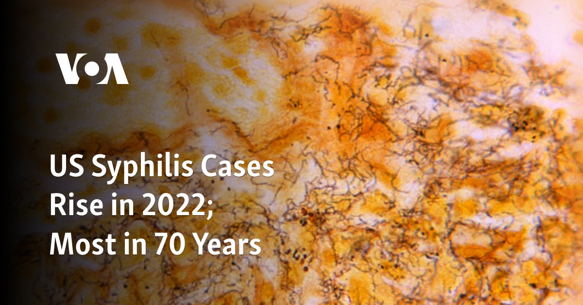 US Syphilis Cases Rise in 2022; Most in 70 Years