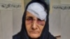 تصویر صورت آسیب‌دیده و سر باندپیچی‌شده گوهر عشقی، مادر ستار بهشتی‌