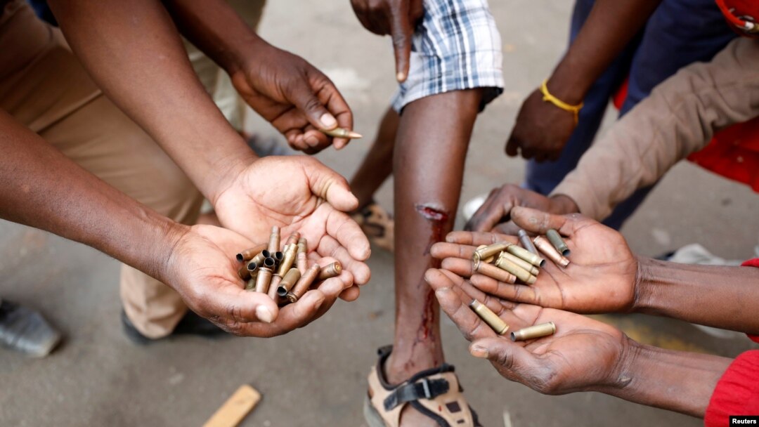 Apoiantes do partido da oposição, MDC, exibem balas e ferimentos depois dos confrontos de 1 de Agosto em Harare