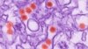 Experimental Zika Vaccine Protects Monkeys