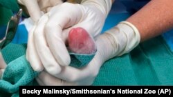 FILE - One of the giant panda cubs is examined by veterinarians after being born at the Smithsonian's National Zoo in Washington, Aug. 22, 2015.