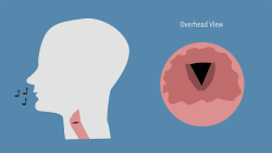 Vocal folds, commonly known as vocal cords, consist of two elastic bands of muscle tissue that vibratee in response to air flow from the lungs to produce sound.