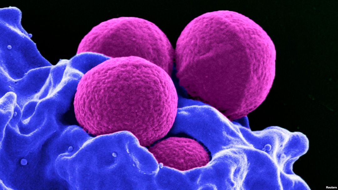 Allergies- Digitally-colorized scanning electron micrograph depicts methicillin-resistant Staphylococcus aureus...