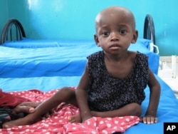 A malnourished child Bosaso in northwest Somalia, September 2010