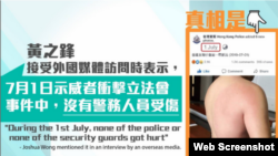 港警在脸书晒一名警员受伤图反驳黄之锋。 (香港警察脸书截图)