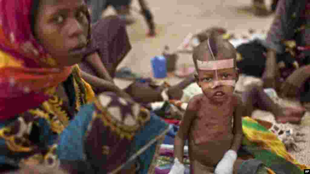 Halime Moussa, 3, reçoit un traitement par un tube d&#39;alimentation nasal et &nbsp;avec les mains bandées pour l&#39;empêcher de retirer, à la salle de nutrition thérapeutique de l&#39;hôpital de la ville, dont sa mère Kaltouma Abakar, à gauche, a voyagé 70 km pour atteindre, à Mao, capitale de la région du Kanem au Tchad, le mardi 17 Avril 2012. (AP Photo / Ben Curtis) 