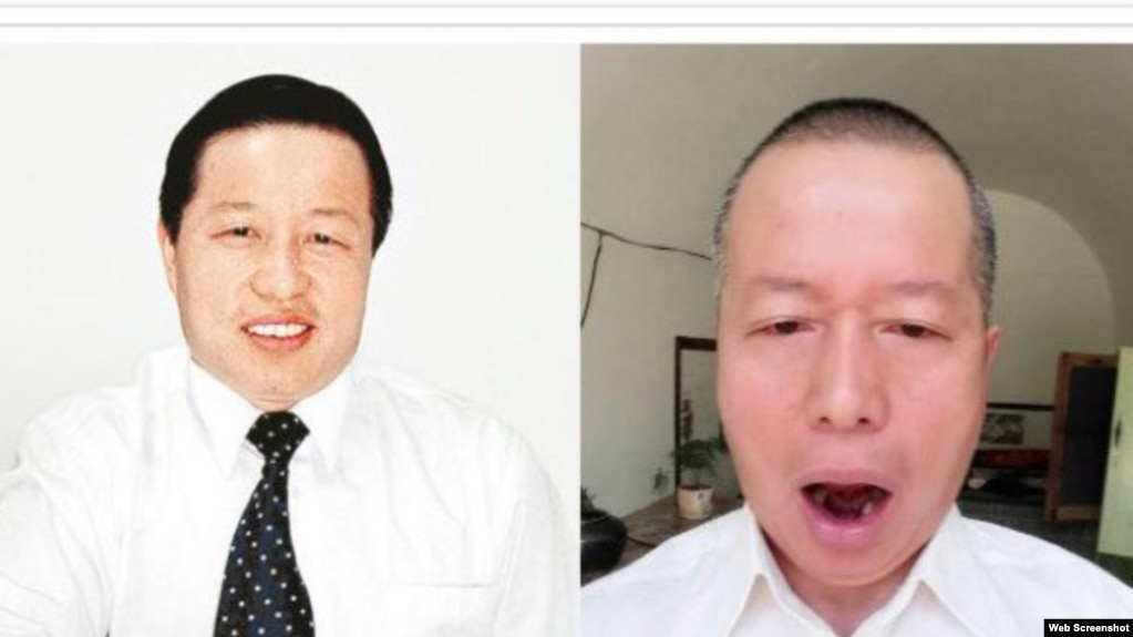 人权律师高智晟牙齿脱落(推特图片)