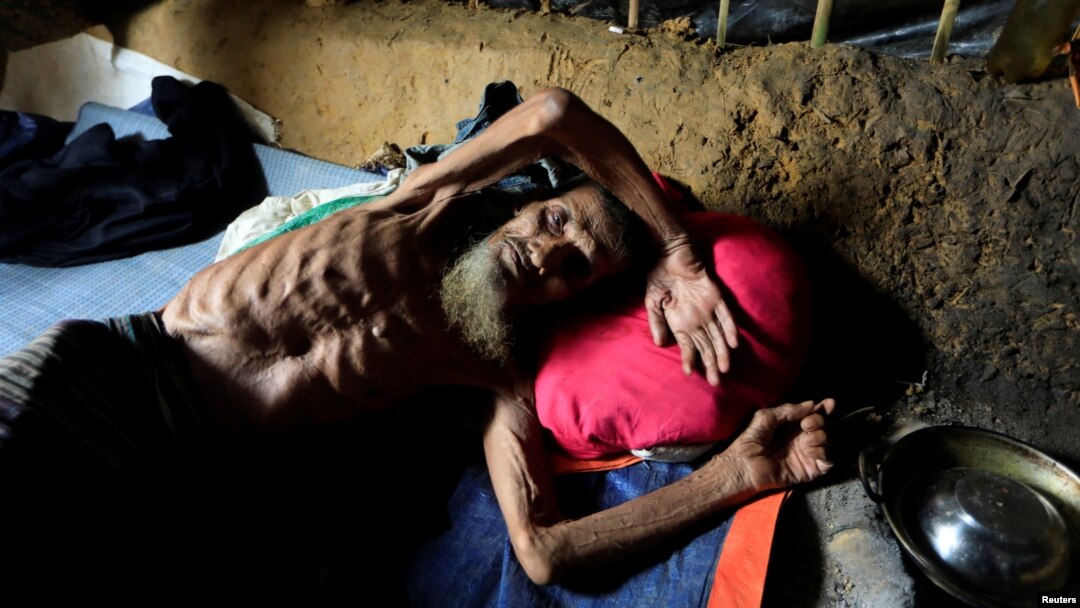 Seorang pria lansia Muslim Rohingya berbaring di tendanya di kamp pengungsi Kutupalong di Cox's Bazar, Bangladesh. 