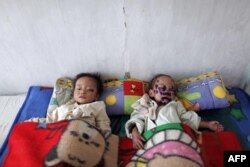 Besin yetersizliğinden hasta çocuklar