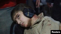 Một bé trai bị thương, sau vụ không kích mà các nhà hoạt động nói rằng do lực lượng trung thành với Tổng thống al-Assad thực hiện, chờ được chữa trị tại một bệnh viện dã chiến, 23/12/14