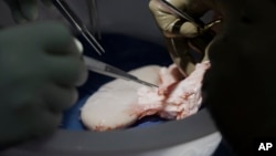 Surgeons at NYU Langone Health prepare to transplant a pig's kidney into a brain-dead man in New York on July 14, 2023. (AP Photo/Shelby Lum)