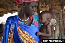 Elizabeth Nyakoda holds her severely underfed 10-month old daughter at the feeding center for children in Jiech, Ayod County, South Sudan. (Sam Mednick/AP)