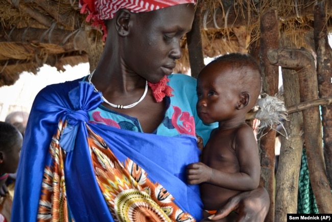 Elizabeth Nyakoda holds her severely underfed 10-month old daughter at the feeding center for children in Jiech, Ayod County, South Sudan. (Sam Mednick/AP)