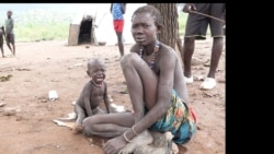 A hungry baby and her mother at Niapuru camp for internal displaced persons in Jebel Boma County. (John Tanza/VOA)