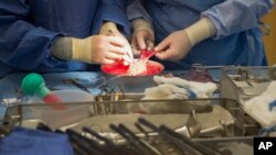 FILE - In this June 28, 2016, file photo, surgeons work on a kidney during a kidney transplant surgery at MedStar Georgetown University Hospital in Washington. (AP Photo/Molly Riley)