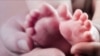 Tử vong ở trẻ sơ sinh phần lớn do các biến chứng và sinh non 