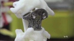 Chinese Doctors Use 3-D Spinal Implant