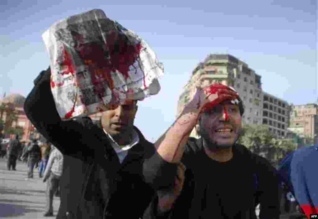 Injured anti-Mubarak protesters bleed following clashes with his supporters in Cairo, Egypt, Wednesday, Feb.2, 2011. Several thousand supporters of President Hosni Mubarak, including some riding horses and camels and wielding whips, clashed with anti-gove