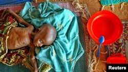 FILE - A malnourished infant lies on the floor in a therapeutic feeding center run by the medical charity Medecins Sans Frontiers in Maradi, southern Niger. 