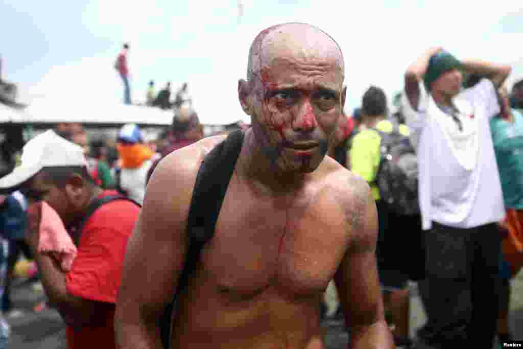 A Honduran migrant, part of a caravan trying to reach the U.S., bleeds after he storms a border checkpoint in Guatemala, in Ciudad Hidalgo, Mexico, Oct. 19, 2018. 