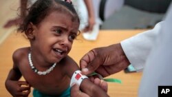 In this Oct. 1, 2018, photo, a doctor measures the arm of malnourished girl at the Aslam Health Center, Hajjah, Yemen. 