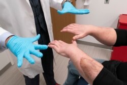 جو دی‌میو توانایی دستهایش را به دکتر ادواردو رادریگز نشان می دهد. تیم پزشکی با رهبری دکتر رادریگز دو دست دی‌میو که در اثر سوختگی آسیب دیده بود را قطع کرده و این دست‌ها را به او پیوند زدند.