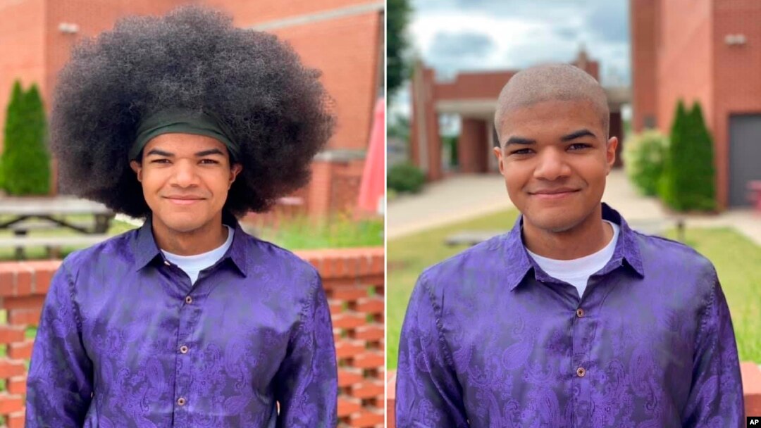 Kieran Moïse (17 tahun) menyumbangkan rambutnya untuk anak-anak penderita kanker lewat "Kieran's Curls for Cancer" (foto dok. AP)