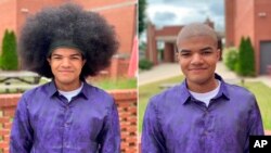 Kieran Moïse (17 tahun) menyumbangkan rambutnya untuk anak-anak penderita kanker lewat "Kieran's Curls for Cancer" (foto dok. AP)