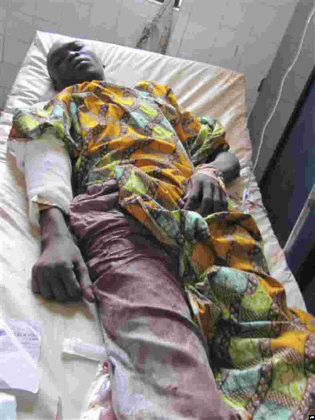 A victim of Friday's bomb blast and gun attacks lies in Murtala Muhammad specialist hospital in Kano, Nigeria Saturday, Jan. 21, 2012.