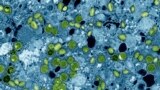 FILE - This colorized electron microscope image provided by the National Institute of Allergy and Infectious Diseases in 2024 shows Mpox virus particles, green, found within infected cultured cells, blue. (NIAID via AP, File)