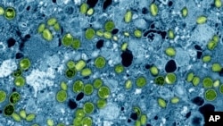 FILE - This colorized electron microscope image provided by the National Institute of Allergy and Infectious Diseases in 2024 shows Mpox virus particles, green, found within infected cultured cells, blue. (NIAID via AP, File)