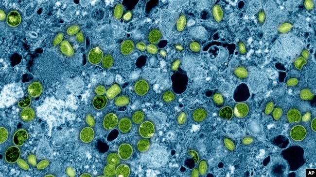 FILE - This colorized electron microscope image provided by the National Institute of Allergy and Infectious Diseases in 2024 shows Mpox virus particles, green, found within infected cultured cells, blue. (NIAID via AP, File)