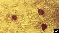 Imagen de microscopio de 1975, provista por los Centros para Control y Prevención de Enfermedades, muestra la bacteria chlamydia trachomatis magnificada 200 veces. 