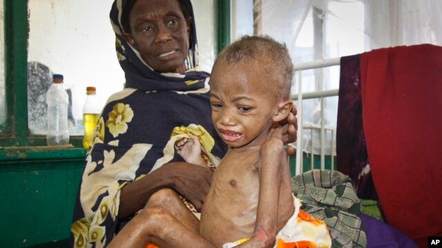 La mayoría de estos niños, viven en países subdesarrollados.