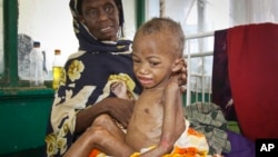 Abdulahi Musa, a malnourished five-year-old boy, sits on his mother's lap at Banadir hospital in Mogadishu, Somalia, May 20, 2014.