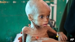 FILE: Acutely malnourished child Sacdiyo Mohamed, 9 months old, is treated at the Banadir Hospital after her mother Halima Hassan Mohamed fled the drought in southern Somalia and traveled by car to the capital Mogadishu. Taken 3.11.2017