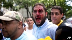 Archivo. El diputado opositor Juan Requesens (centro) es retirado por su colega José Manuel Olivares (derecha) después de ser herido por partidarios del gobierno, durante protestas en la oficina del defensor del pueblo en Caracas, Venezuela, el 3 de abril de 2017. 