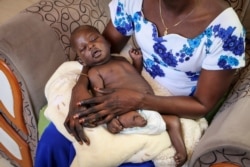 FILE - Baby boy Ping Mayak Geer, who was born with six fingers on each hand, one stunted leg, a deformed foot and kidney swelling, lies on his mother's lap, Nov. 28, 2019, in Nairobi, Kenya.