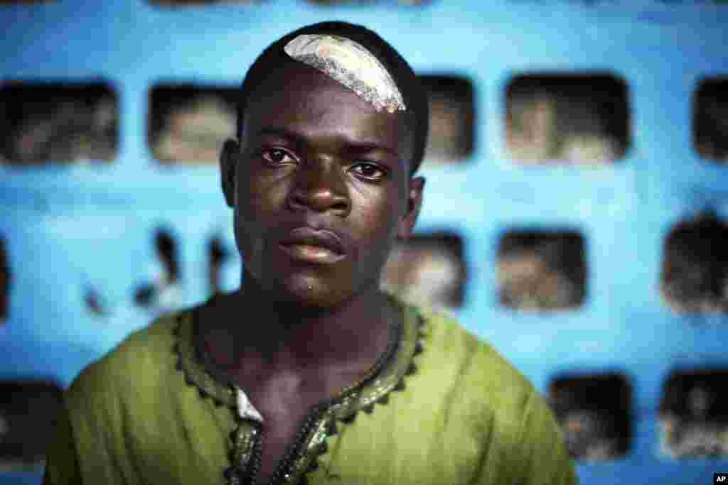 Reyes Wolee, 19, a political science student who said he received 24 stitches after Liberian police beat him with their rifle butts when they stormed the opposition Congress for Democratic Change headquarters on Monday, shows one of his four head wounds i