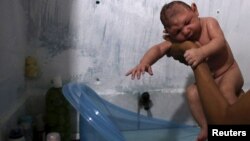مادران مبتلا به ویروس زیکا، نوزادانی با سر کوچک به دنیا می آورند.