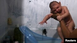 Daniele Santos, 29, holds her son Juan Pedro who is 2-months-old and born with microcephaly, after bathing him at their house in Recife, Brazil, Feb. 9, 2016. 