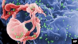 ویروس «اچ آی وی» بر سطح یک سلول، عکس از مرکز کنترل و پیشگیری بیماری