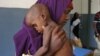 ONU: Uno de cada ocho padece hambre