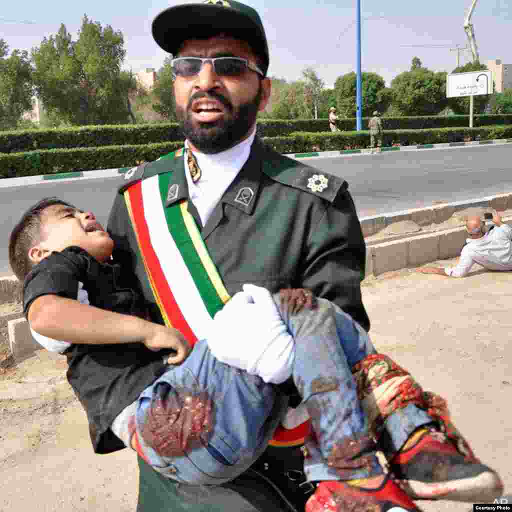 کودک زخمی شده در حملۀ روز شنبه در شهر اهواز ولایت خوزستان ایران 