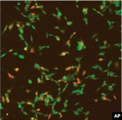 Brain cells expressing human FOXP2. Cells that are orange/red have high FOXP2 expression